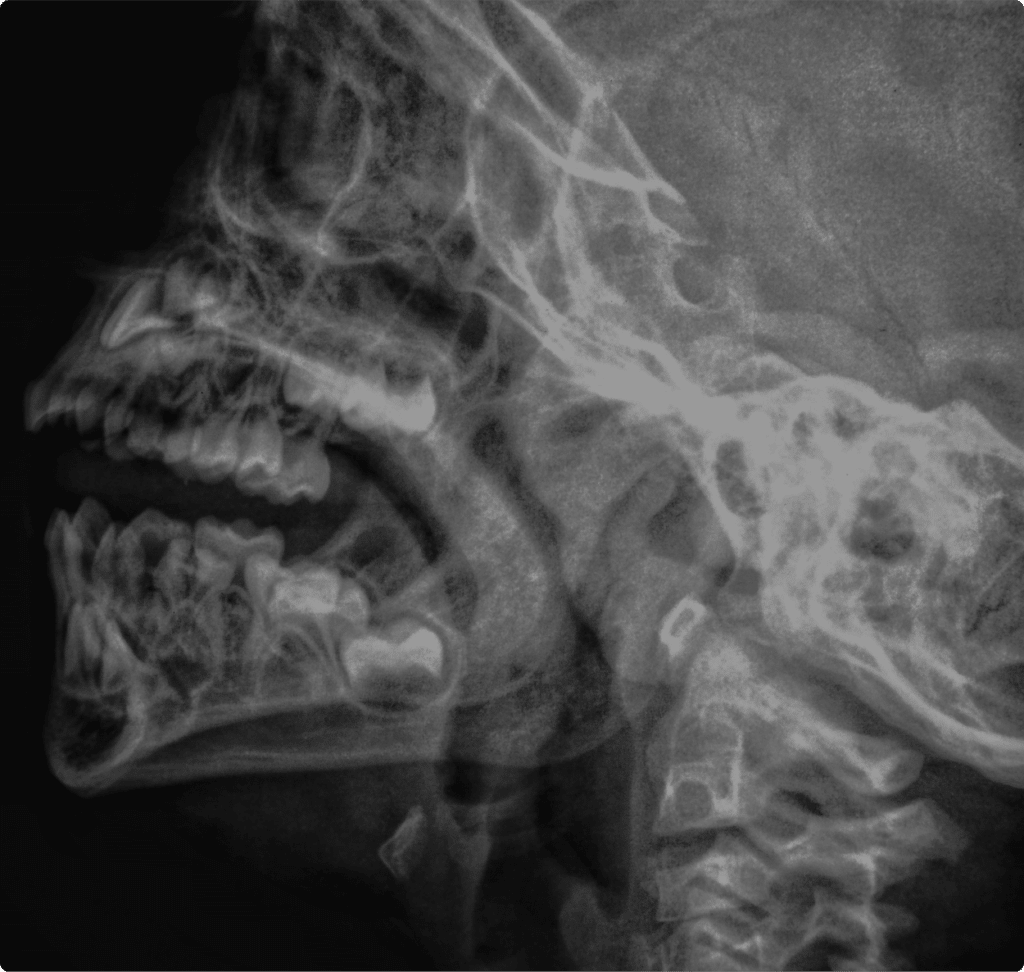 une Radia d'une personne