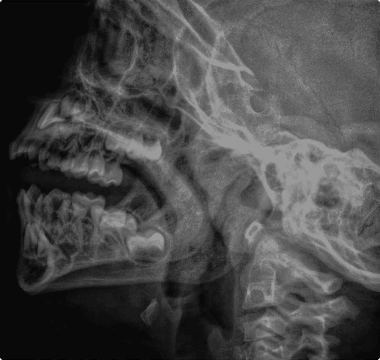 une Radia d'une personne