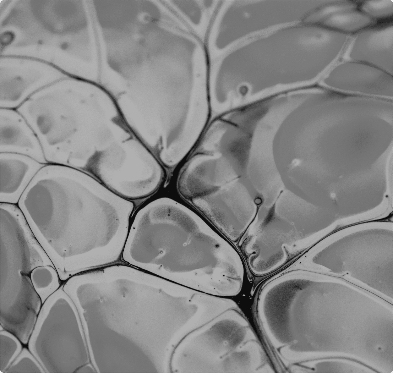 Analyse vu au microscope